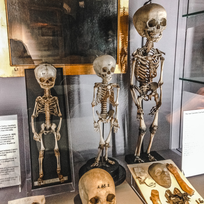 Hunterian Museum - Royal College of Surgeons